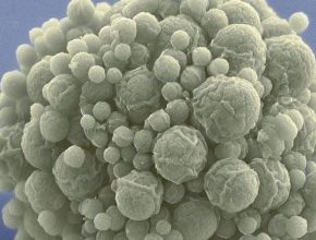 Científicos “simplifican” una bacteria y hablan de evolución